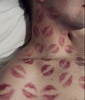 kisses
